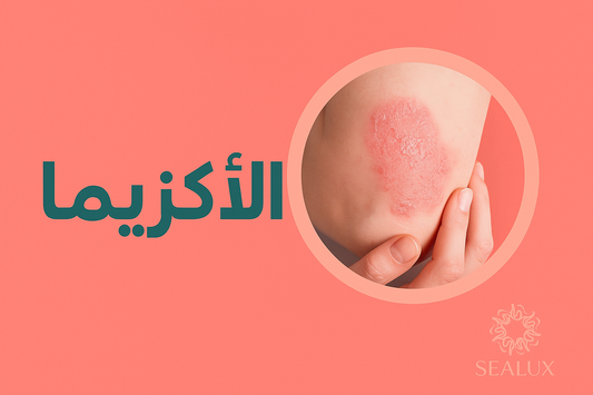 الأكزيما