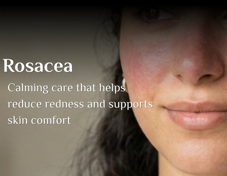 Rosacea