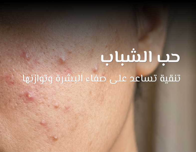 How dead sea help in acne